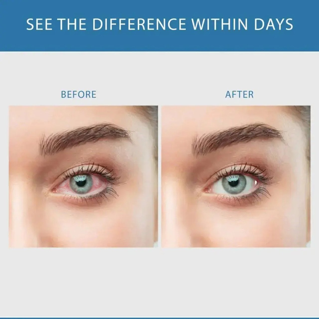 3 Bottle - BUNDLE DEAL - Sclera White | Eye-Whitening – image 4